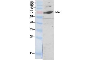 Western Blotting (WB) image for anti-Cytochrome C Oxidase Subunit II (COX2) antibody (ABIN5959232) (COX2 antibody)