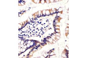 (ABIN655163 and ABIN2844780) staining CYP11B2 in human small intestine tissue sections by Immunohistochemistry (IHC-P - paraformaldehyde-fixed, paraffin-embedded sections). (CYP11B2 antibody  (AA 120-147))