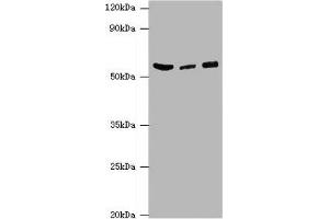 Western blot All lanes: HARS antibody at 6 μg/mL Lane 1: Hela whole cell lysate Lane 2: K562 whole cell lysate Lane 3: 293T whole cell lysate Secondary Goat polyclonal to rabbit IgG at 1/10000 dilution Predicted band size: 58, 53, 51, 55 kDa Observed band size: 58 kDa (HARS1/Jo-1 antibody  (AA 1-180))