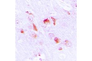 Immunohistochemical analysis of Apolipoprotein L2 staining in human brain formalin fixed paraffin embedded tissue section. (Apolipoprotein L 2 antibody  (Center))