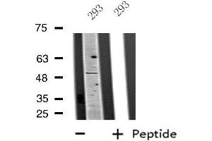 Western blot analysis of extracts from 293 cells, using PLAGL1 antibody. (PLAGL1 antibody  (Internal Region))