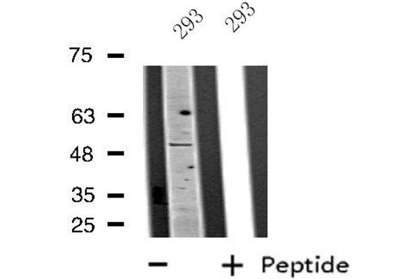 PLAGL1 antibody  (Internal Region)