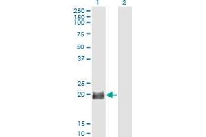 Western Blot analysis of EXOSC1 expression in transfected 293T cell line by EXOSC1 monoclonal antibody (M01), clone 2E9. (EXOSC1 antibody  (AA 1-195))