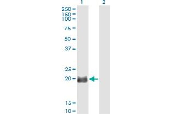 EXOSC1 Antikörper  (AA 1-195)