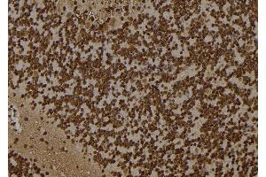 ABIN6261257 and ABIN6277502 at 1/100 staining Rat brain tissue by IHC-P.