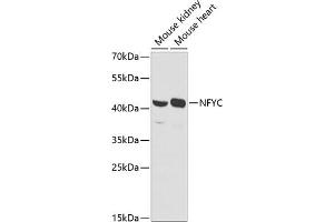 Western blot analysis of extracts of various cell lines, using NFYC antibody (ABIN6129066, ABIN6144604, ABIN6144605 and ABIN6225149) at 1:1000 dilution. (NFYC antibody  (AA 86-335))