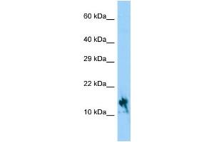 Host: Rabbit Target Name: IGFL1 Sample Type: Hela Whole Cell lysates Antibody Dilution: 1. (IGFL1 antibody  (C-Term))