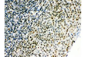 Anti- CTBP1 Picoband antibody, IHC(P) IHC(P): Human Tonsil Tissue (CTBP1 antibody  (C-Term))