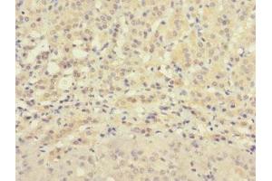Immunohistochemistry of paraffin-embedded human adrenal gland tissue using ABIN7176327 at dilution of 1:100 (ZNF462 antibody  (AA 2223-2506))