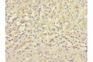 Immunohistochemistry of paraffin-embedded human adrenal gland tissue using ABIN7176327 at dilution of 1:100