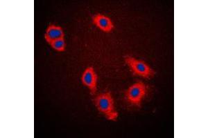 Immunofluorescent analysis of Caspase 9 staining in HeLa cells. (Caspase 9 antibody  (Center))