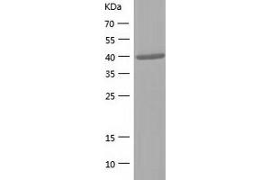 Western Blotting (WB) image for Aldolase B, Fructose-Bisphosphate (ALDOB) (AA 1-364) protein (His tag) (ABIN7285000) (ALDOB Protein (AA 1-364) (His tag))