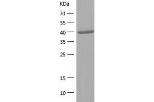 ALDOB Protein (AA 1-364) (His tag)