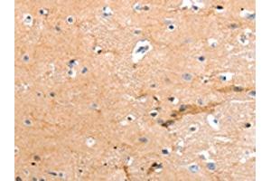 The image on the left is immunohistochemistry of paraffin-embedded Human brain tissue using ABIN7190856(GPR64 Antibody) at dilution 1/55, on the right is treated with synthetic peptide.