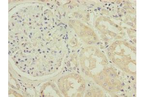 Immunohistochemistry of paraffin-embedded human kidney tissue using ABIN7173395 at dilution of 1:100 (TMLHE antibody  (AA 16-376))