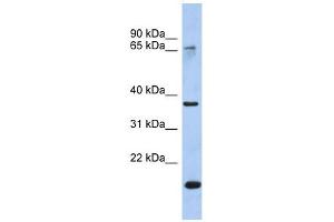 ARHGDIG antibody used at 1 ug/ml to detect target protein. (Ig antibody)