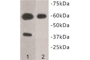 Western Blotting (WB) image for anti-Transmembrane Protein 57 (TMEM57) antibody (ABIN1854993) (TMEM57 antibody)