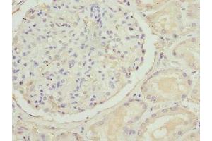 Immunohistochemistry of paraffin-embedded human kidney tissue using ABIN7170139 at dilution of 1:100 (SLC22A11 antibody  (AA 40-150))