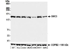 Western Blotting (WB) image for anti-Structural Maintenance of Chromosomes 3 (SMC3) (AA 1175-1217) antibody (ABIN7453329) (Recombinant SMC3 antibody  (AA 1175-1217))