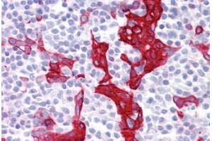 Anti-Keratin 10/13 antibody IHC staining of human tonsil. (Keratin 10/13 antibody)