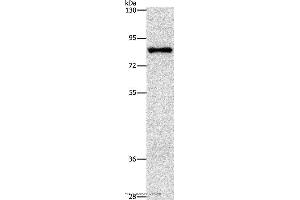 Western blot analysis of Hela cell, using NOL9 Polyclonal Antibody at dilution of 1:1250
