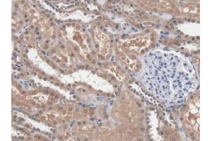 Detection of DICER1 in Human Kidney Tissue using Polyclonal Antibody to Dicer 1, Ribonuclease Type III (DICER1) (DICER1 antibody  (AA 6-290))