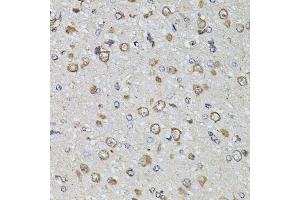 Immunohistochemistry of paraffin-embedded rat brain using FGF2 antibody. (FGF2 antibody)