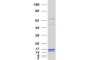 Validation with Western Blot
