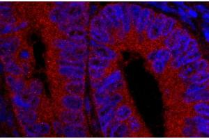 Immunofluorescence (IF) image for anti-Ubiquitin Specific Peptidase 5 (USP5) (AA 375-425) antibody (ABIN7449032) (USP5 antibody  (AA 375-425))