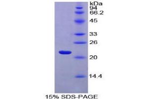 SDS-PAGE (SDS) image for Ferritin, Light Polypeptide (FTL) (AA 1-175) protein (His tag) (ABIN1079505) (FTL Protein (AA 1-175) (His tag))