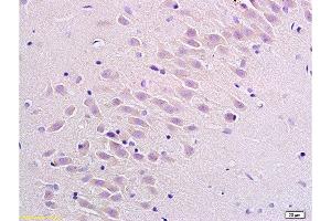 Formalin-fixed and paraffin embedded rat brain labeled with Anti Substance P Receptor/NK1R Polyclonal Antibody, Unconjugated  at 1:200 followed by conjugation to the secondary antibody Goat Anti-Rabbit IgG, PE conjugated -PE)used at 1:200 dilution for 40 minutes at 37°C. (TACR1 antibody  (AA 2-50))