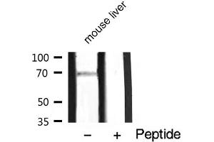 Western blot analysis of PKC zeta phosphorylation expression in mouse liver lysates,The lane on the right is treated with the antigen-specific peptide.