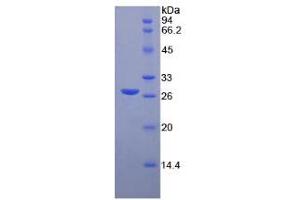 SDS-PAGE of Protein Standard from the Kit (Highly purified E. (MMP2 CLIA Kit)