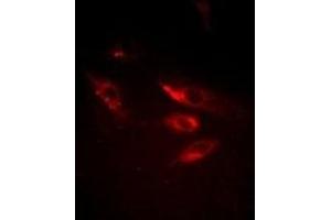 Immunofluorescent analysis of SRPK1 staining in MCF7 cells. (SRPK1 antibody)