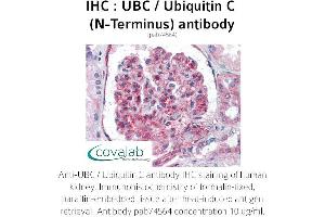 Image no. 1 for anti-Ubiquitin C (UBC) (N-Term) antibody (ABIN4889895) (UBC antibody  (N-Term))