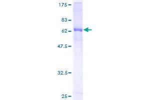 AMBP Protein (AA 19-352) (GST tag)