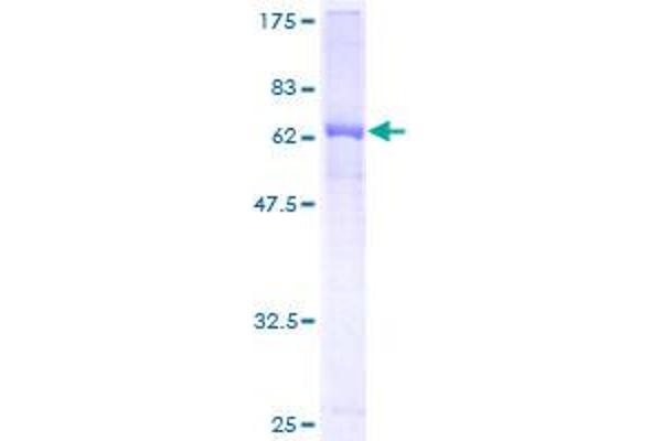 AMBP Protein (AA 19-352) (GST tag)