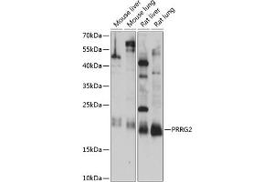 Western blot analysis of extracts of various cell lines, using PRRG2 antibody (ABIN7269558) at 1:1000 dilution. (PRRG2 antibody  (AA 1-179))