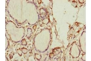 Immunohistochemistry of paraffin-embedded human thyroid tissue using ABIN7170585 at dilution of 1:100 (SPICE1 antibody  (AA 1-220))