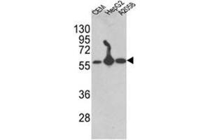 Western blot analysis of AP17615PU-N P4HB antibody (C-term) in CEM,HepG2, A2058 cell line lysates (35 µg/lane). (P4HB antibody  (C-Term))
