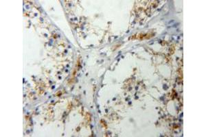 Used in DAB staining on fromalin fixed paraffin-embedded testis tissue (IGF2 antibody  (AA 25-91))