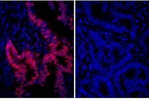 Immunofluorescence (IF) image for Goat anti-Rabbit IgG (Heavy & Light Chain) antibody (DyLight 594) - Preadsorbed (ABIN7446879)
