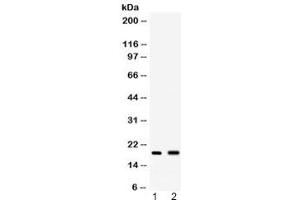 Western blot testing of 1) mouse spleen and 2) mouse liver lysate with PYY antibody at 0. (Peptide YY antibody  (AA 29-64))