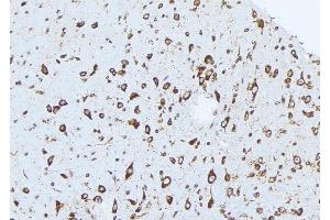 ABIN6273036 at 1/100 staining Mouse brain tissue by IHC-P. (Complexin 1 antibody  (N-Term))
