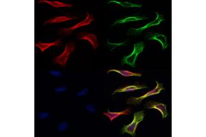 ABIN6260870 and ABIN6266837 staining Hela by IF/ICC. (Claudin 7 antibody  (C-Term))