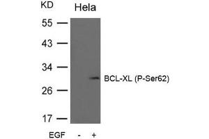 Western blot analysis of extracts from Hela cells untreated or treated with EGF using BCL-XL (Phospho-Ser62) Antibody. (BCL2L1 antibody  (pSer62))