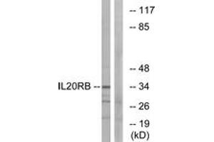 Western blot analysis of extracts from HeLa cells, using IL20RB Antibody. (IL20RB antibody  (AA 141-190))