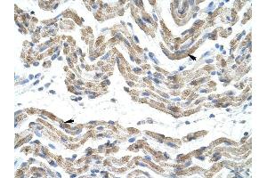 SFRS10 antibody was used for immunohistochemistry at a concentration of 4-8 ug/ml to stain Skeletal muscle cells (arrows) in Human Muscle. (TRA2B antibody)