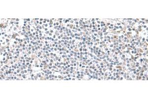 Immunohistochemistry of paraffin-embedded Human tonsil tissue using PAM16 Polyclonal Antibody at dilution of 1:60(x200)