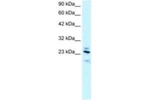 Western Blotting (WB) image for anti-Regulator of G-Protein Signaling 20 (RGS20) antibody (ABIN2460854) (RGS20 antibody)